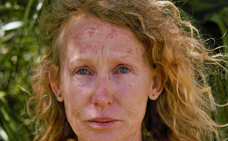 Kerri Tonkin, pictured after police pepper sprayed her while she was locked onto equipment in protest at coal seam gas mining in the Pilliga.