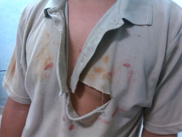 A young unaccompanied minor on Nauru was one of four boys assaulted by Naruan men and hospitalised over the weekend.