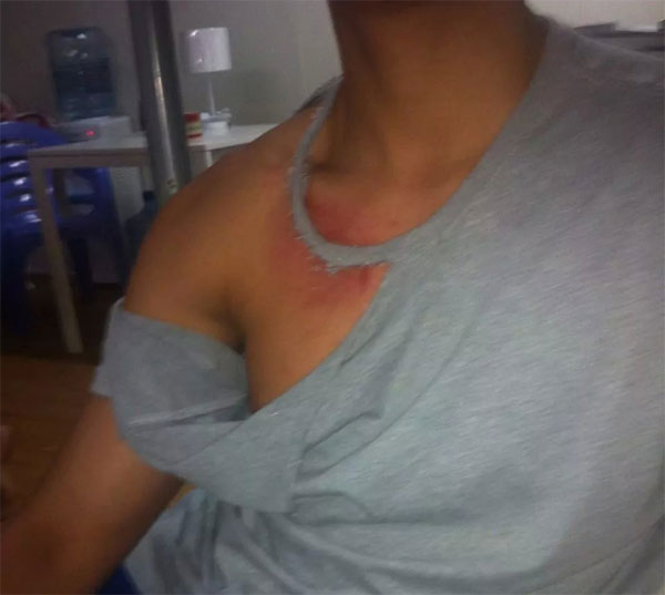 One of the unaccompanied minors assaulted recently on Nauru.